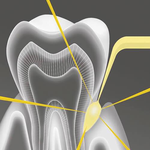 Parodontologia e trattamento a laser